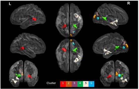 Frontiers Structural And Functional Mri Differences In Master