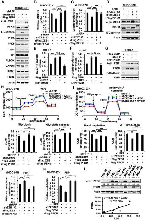 Zeb1 Enhances Warburg Effect To Facilitate Tumorigenesis And Metastasis