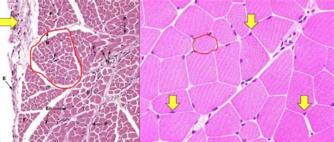 Skeletal Muscle Cross Section Diagram Quizlet