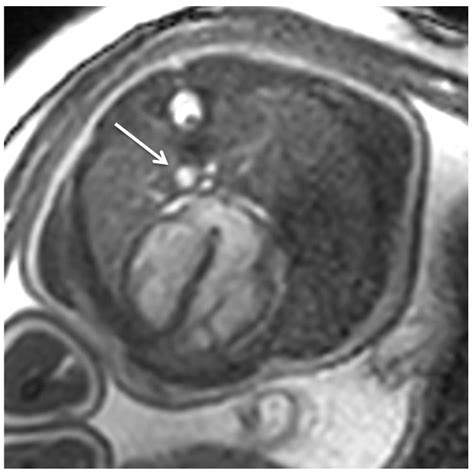 Jcm Free Full Text The Evolution And Developing Importance Of Fetal Magnetic Resonance