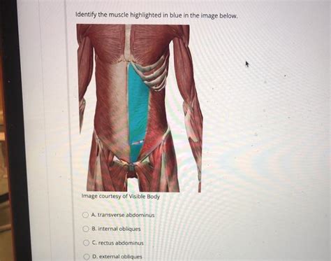 Solved Identify The Muscle Highlighted In Blue In The Image Chegg