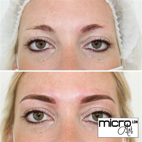 Before And After Pictures Of Semi Permanent Makeup Saubhaya Makeup