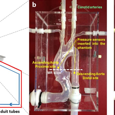 A Schematic Representation Of The Experimental Setup B Aorta