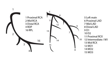 Coronary Anatomy Pcipedia