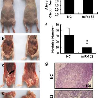 The Overexpression Of MiR 152 Enhanced Cisplatin Sensitivity In Vivo