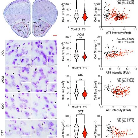 Neuronal Size In Olfactory Bulb Associated Areas Is Inversely