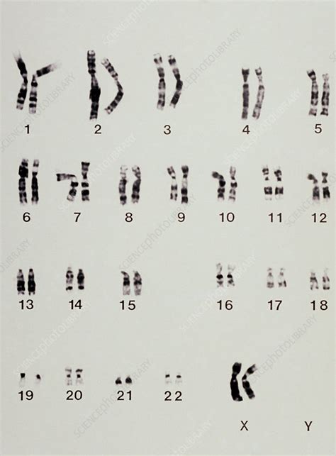 Karyotype Showing Arrangement Of Chromosomes Stock Image M3520004 Science Photo Library