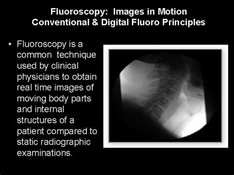 Introduction To Fluoroscopy Radiation Safety Rtec