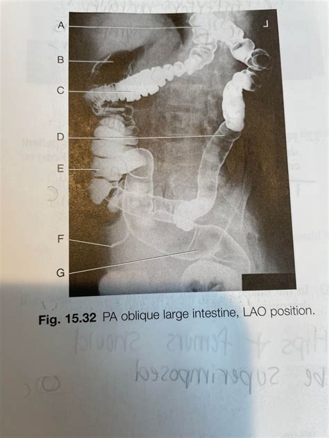 PA Oblique Large Intestine Diagram Quizlet