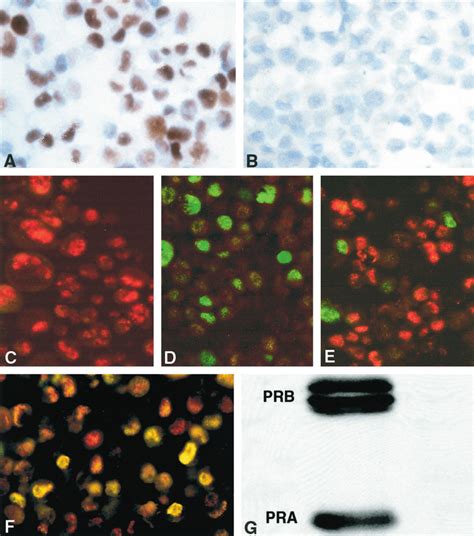 Immunoperoxidase Localization Of Prb In Sections Of A Pr Negative Cell