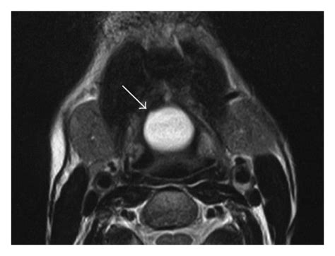 A Sagittal T1 Weighted Tr Te 585 10 B Sagittal T2 Weighted