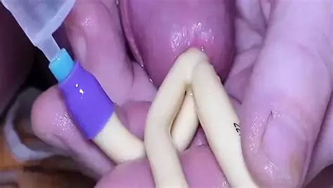 Blasenkatheter Legen Free Gay Porn Video XHamster