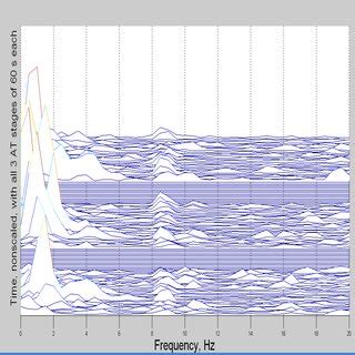 Compressed Power Spectral Arrays Of The Eeg In The Frequency Region