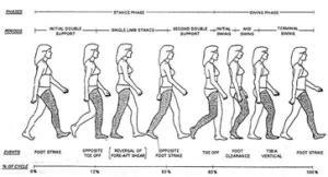 Gait Training In Stroke Physiopedia