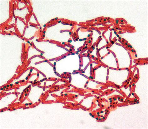 Ex Bacterial Structures Endospore Stain Flashcards Quizlet