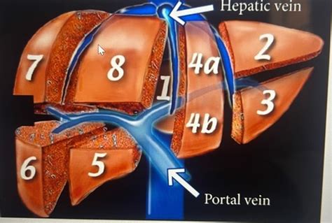 DMS 207 Exam 1 Ch 1 4 Diagram Quizlet