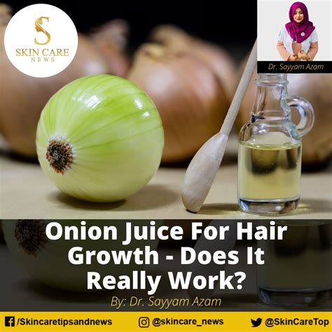 Onion Juice For Hair Growth Does It Really Work