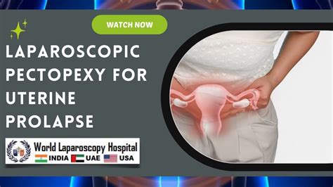 Laparoscopic Pectopexy For Apical Uterine Prolapse Satisfactory