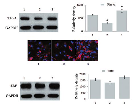 A Western Blot Analysis Of Rhoa Expression In Vsmcs B