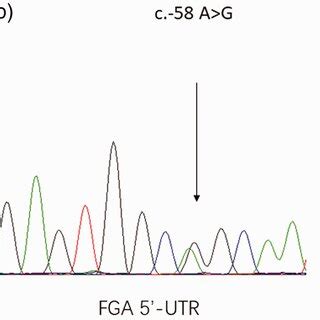 Genetic Analysis Showed A Heterozygous Missense Mutation C C T P