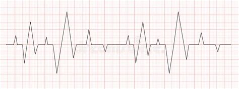 Zwarte Hartslagdiagram Op Rood Grafiekpapier Elektrocardiogram