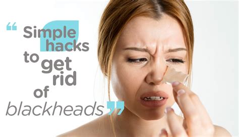 Simple Hacks To Get Rid Of Blackheads On Your Nose Chin And Forehead