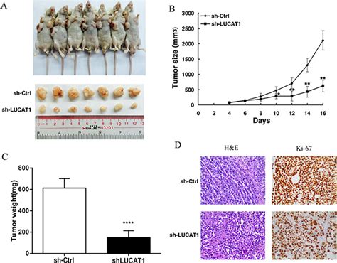 Long Non Coding Rna Lucat1 Is Associated With Poor Prognosis In Human