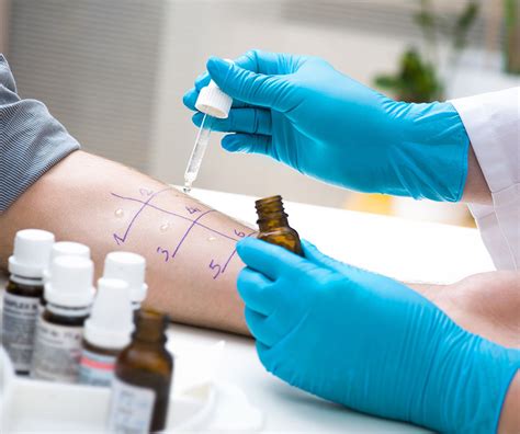 Private Allergy Testing London Skin Prick Test From £38