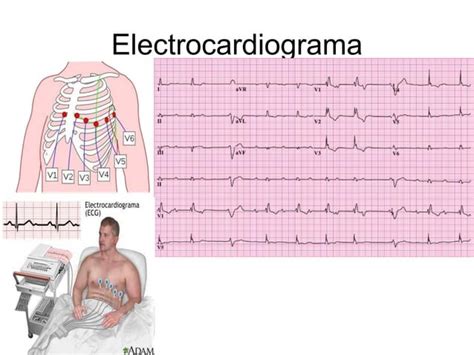 Diagnostico Y Tecnicas De Diagnostico PPT Descarga Gratuita