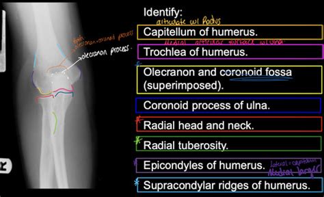 Upper Extremity Normal Radiographic Anatomy Elbow Wrist And Hand