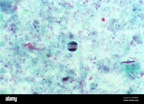 This Photomicrograph Of A Trichrome Stained Specimen Revealed The Presence Of A Parasitic Cyst