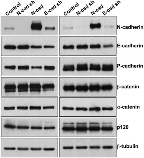 Western Blot Analysis Of N E Or P Cadherin Or Catenin P Ctn