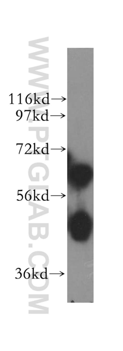 Aldh A Rabbit Anti Human Mouse Rat Polyclonal Proteintech L