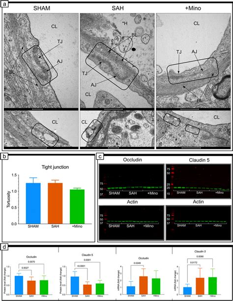 Tight Junction Ultrastructure And Occludin Or Claudin Protein Levels