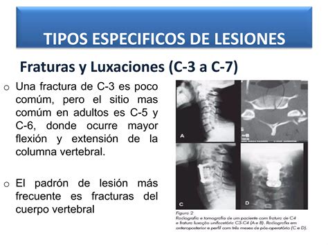 Trauma De La Columna Vertebral Y Medula Espinal Ppt