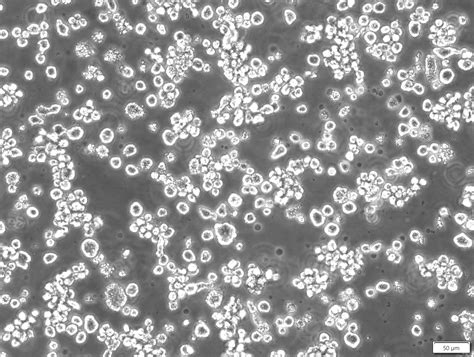 RPMI-8226-Fluc-Puro - Imanis Life Sciences | United States