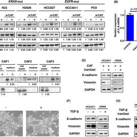 Enhancement Of The Tumorinhibitory Effect Of Tranilast In A Mouse