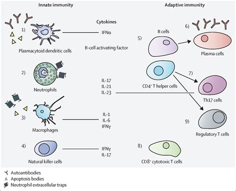 Systemic Lupus Erythematosus The Lancet