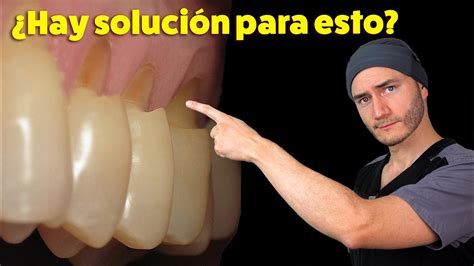 A Fracci N Dental Dudas Dentales Y Odontologicas