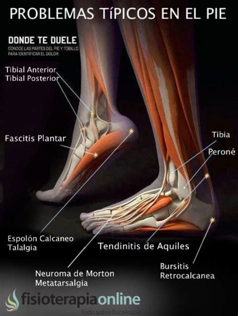 Lesiones De Los Ligamentos Y Tendones Del Pie Todo Lo Que Necesitas Saber