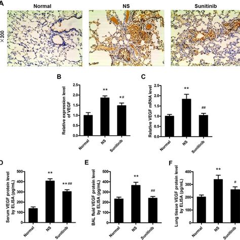 VEGF Expression In COPD Rats A Showed The Strongest Immunolabelling