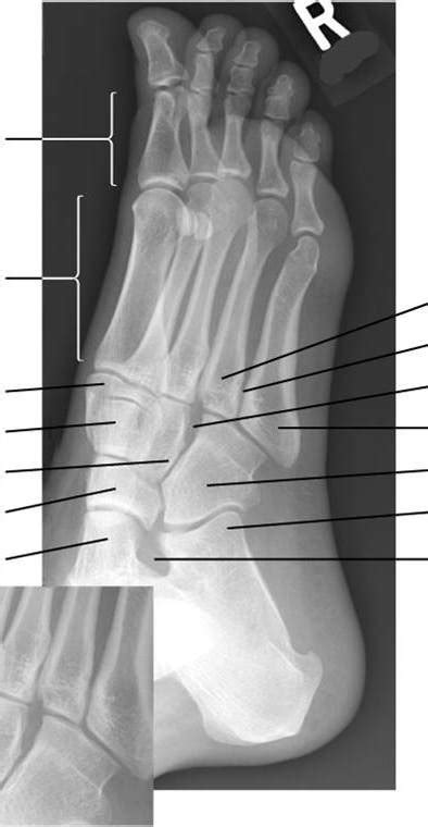 Image Eval Oblique Foot EXAM 4 Diagram Quizlet