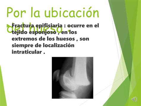 Luxaciones Esguinces Y Fracturas Ppt