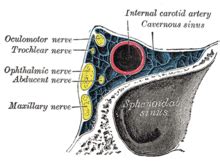 Cavernous sinus thrombosis - Wikipedia