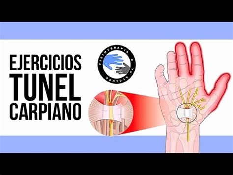 S Ndrome Del Tunel Carpiano Fisioterapia A Tu Alcance