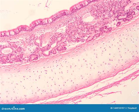 Histology Of Trachea Human Tissue Stock Image Image Of Microscopic