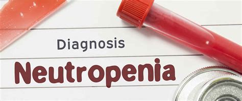 Leukopenia Causes Leukopenia Symptoms And Leukopenia Treatment