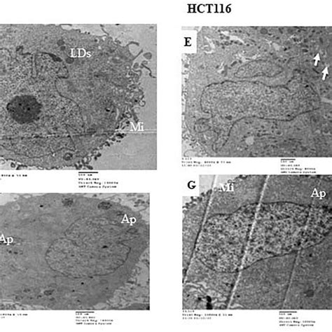 Tem Micrograph Of Ultra Structural Characteristic For Hepg And Hct