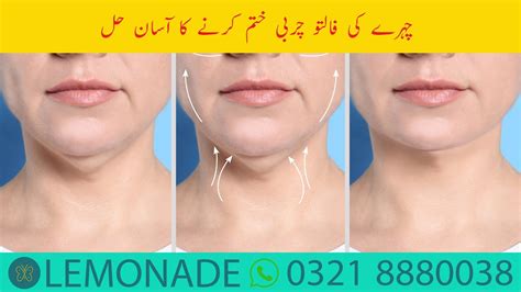 Double Chin Reduction Kaybella Fat Dissolving Injections Weight