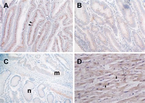 Immunohistochemical Staining For Vegf D In Normal And Malignant